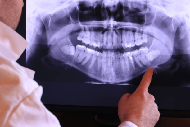 Best Emergency Dentist for Knocked-Out Tooth in Caro, MI