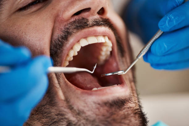 Best Pediatric Emergency Dentist in Caro, MI