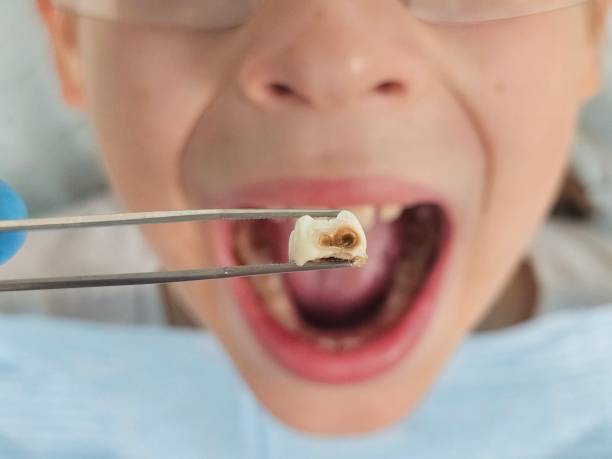 Best Orthodontic Emergency Dentist in Caro, MI